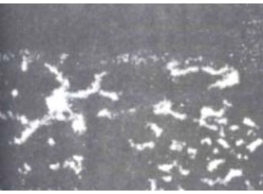 金属偏析现象 金属偏析现象