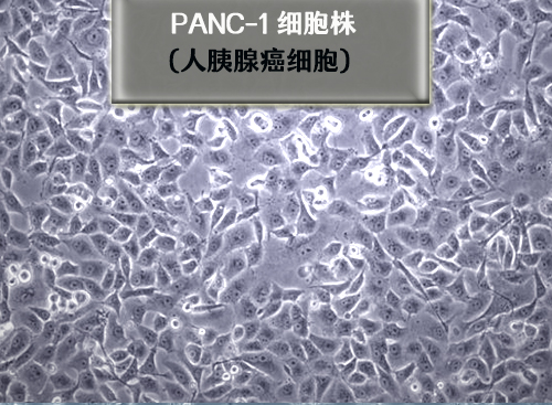 人胰腺癌细胞PANc-1 人胰腺癌细胞PANc-1