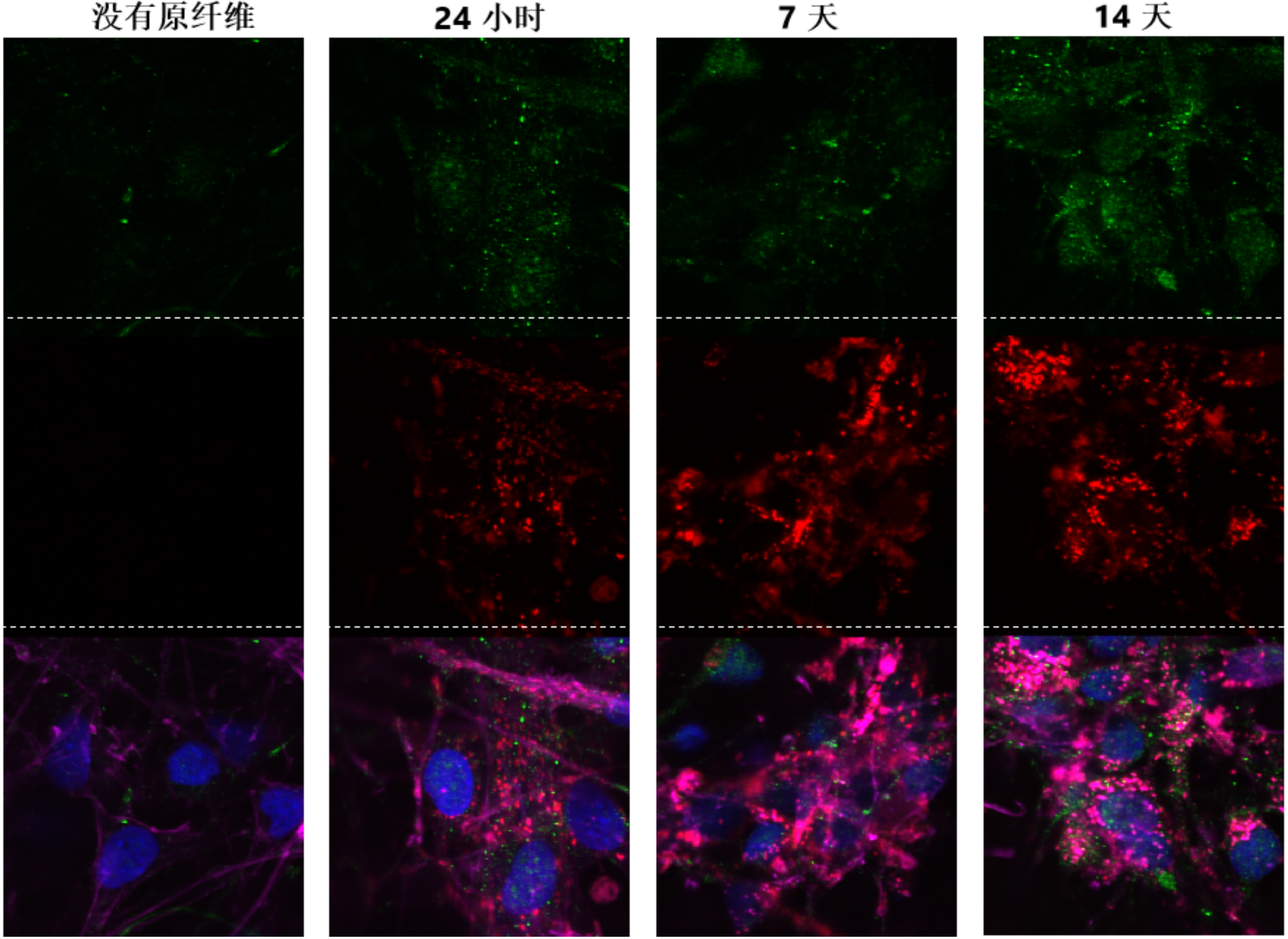 StressMarq的Alpha 突触核蛋白A53T 突变型PFF StressMarq的Alpha 突触核蛋白A53T 突变型PFF