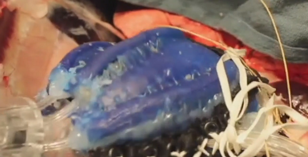 专家称，蛆虫式软体机器人是体内送药的最佳选择