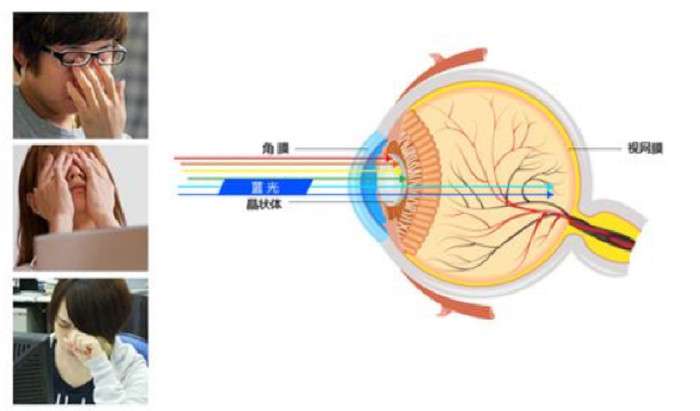 蓝光如此可怕！你还敢轻视蓝光的危害吗？ 