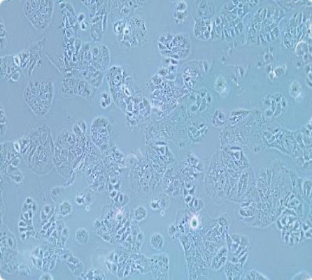 MDA-MB-415 人乳腺癌细胞传代/复苏技巧 