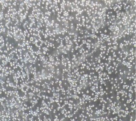 RPMI8226 人多发性骨髓瘤外周血B淋巴细胞传代/复苏操作 