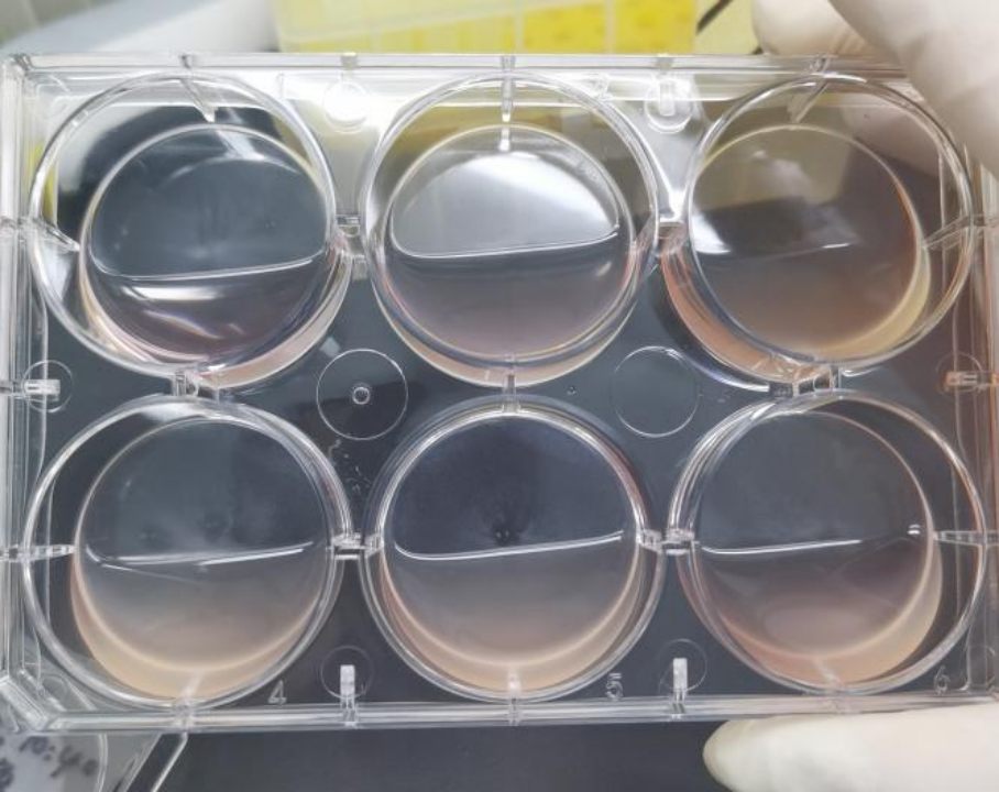 TRIzol提取细胞RNA的经验分享 