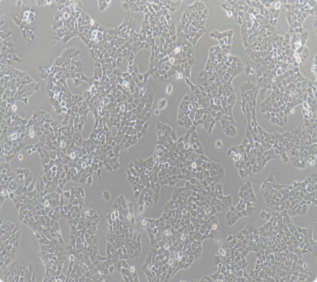 A673 人尤文氏肉瘤细胞传代/复苏操作 