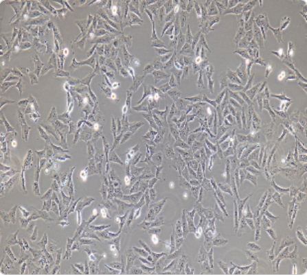 HOS 人骨肉瘤细胞传代/复苏技巧 