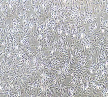 F56 人腺癌细胞系传代/复苏技巧 