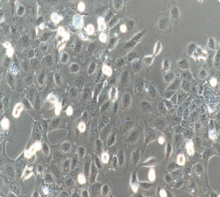 CASKI 人宫颈癌细胞传代/复苏技巧 