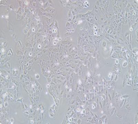 OVCAR-8 人卵巢癌腺癌细胞传代/复苏技巧 