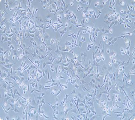 TOV-112D 人上皮性卵巢癌细胞传代/复苏操作 