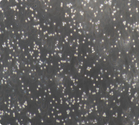 COC1 人卵巢癌细胞传代/复苏技巧 