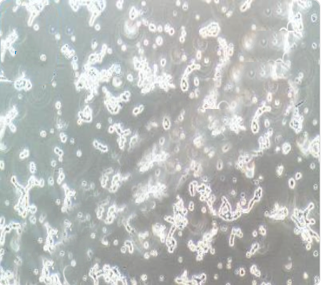 WERI-RB-1 人视网膜神经胶质瘤细胞传代/复苏操作 