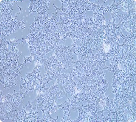 NCCIT 人畸胎癌细胞传代/复苏技巧 