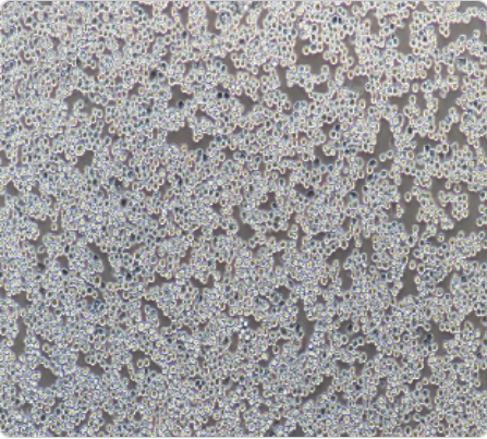 MDA-MB-453 人乳腺癌细胞传代/复苏技巧 