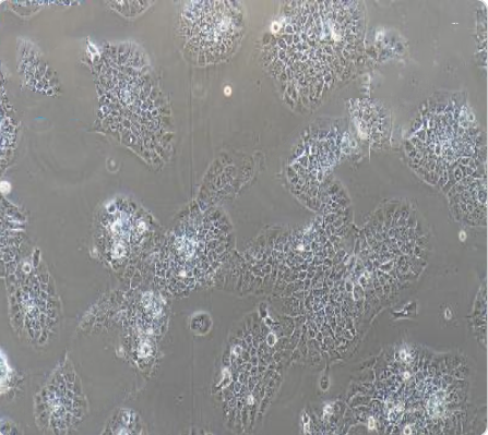 TU212 人喉癌细胞传代/复苏操作 