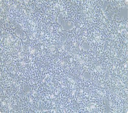 AAV-293 人胚肾细胞传代/复苏技巧 