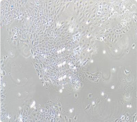 SCaBER 人膀胱鳞癌细胞传代/复苏步骤 