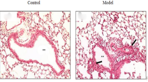 Greer Labs 屋尘螨(HDM)过敏原-哮喘模型制备 