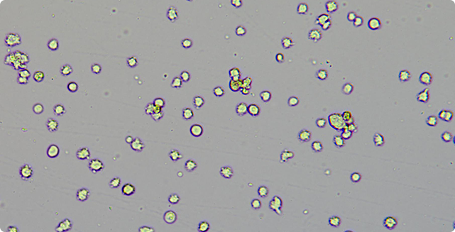 仪器使用小贴士 | 如何判断计数结果的准确性？ 